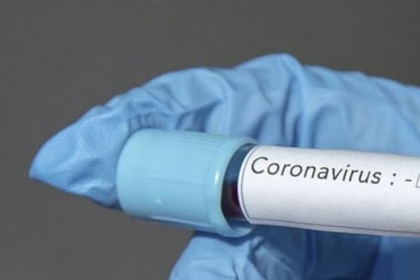 Koronavirusun yayıldığı dövlətlərin adları açıqlandı.Görün siyahıda neçənciyik