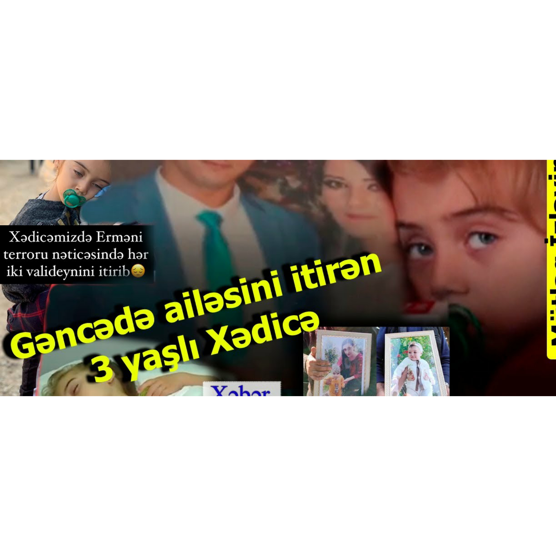 Gəncə faciəsinin mələk üzlü Xədicəsi daha ağır təhlükə ilə üz-üzə- Aidiyyatı qurumlar hərəkətə keçməsə….