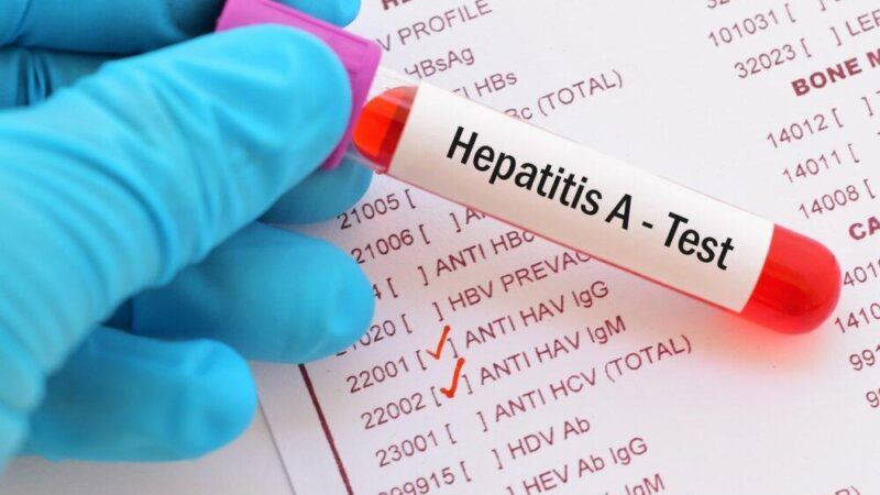 Hepatit daşıyıcıları əsgərliyə aparılmır? – AÇIQLAMA