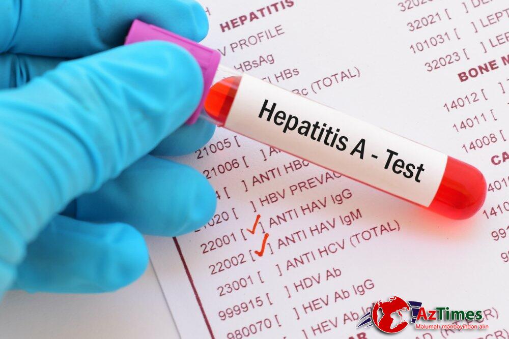 Hepatit daşıyıcıları əsgərliyə aparılmır? – AÇIQLAMA