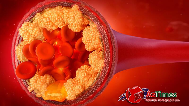 Dietoloq xolesterolu aşağı salan qidaları açıqladı